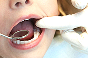口腔外科イメージ